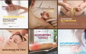 Pack Artes Canva Acupuntura – 30 Templates Editáveis