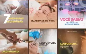 Pack Artes Canva Acupuntura – 30 Templates Editáveis