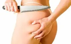 ( 0 Celulites ) Celulitis Cero Produto Vencedor Dolar