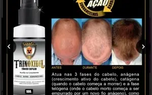Trinoxidiu para calvice