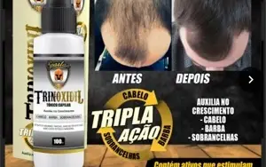 Trinoxidiu para calvice