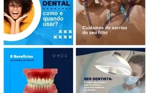 Pack pra Dentista 12 Artes Editáveis Canva