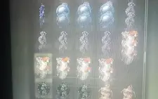 Elden Ring todos itens do jogo Base alguns itens da DLC xbox