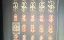 Elden Ring todos itens do jogo Base alguns itens da DLC xbox