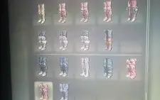 Elden Ring todos itens do jogo Base alguns itens da DLC xbox
