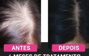 Cabelos Perfeitos