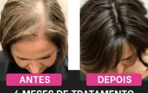 Cabelos Perfeitos