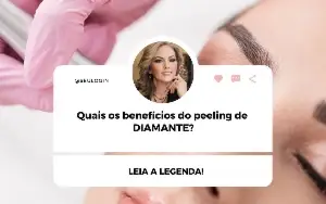 pack +300 artes editáveis estética