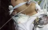 Porfavor ajudem, a filha do meu irmão esta muito doente