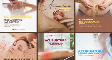 Pack Artes Canva Acupuntura – 30 Templates Editáveis