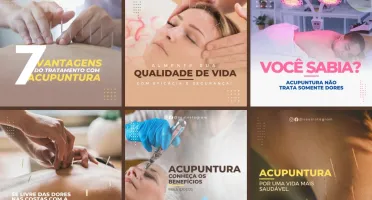 Pack Artes Canva Acupuntura – 30 Templates Editáveis