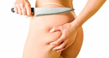 ( 0 Celulites ) Celulitis Cero Produto Vencedor Dolar