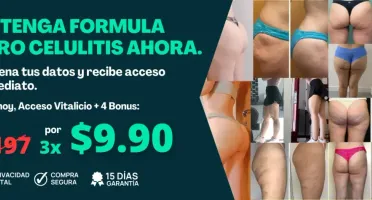 ( 0 Celulites ) Celulitis Cero Produto Vencedor Dolar