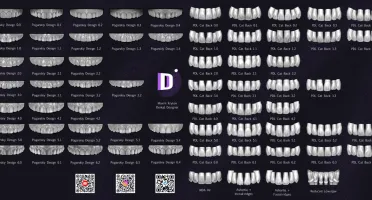 Bibliotecas de Dentes para Exocad