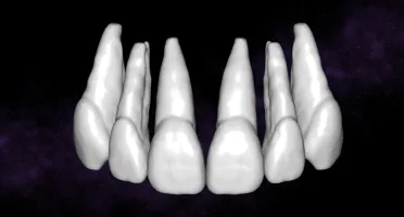 Bibliotecas de Dentes para Exocad