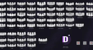 Bibliotecas de Dentes para Exocad