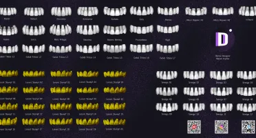Bibliotecas de Dentes para Exocad