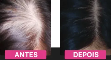Cabelos Perfeitos