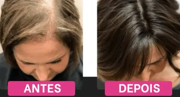Cabelos Perfeitos
