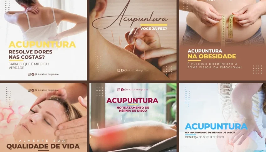 Pack Artes Canva Acupuntura – 30 Templates Editáveis