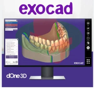 Instalação Exocad última versão e 1500 Biblioteca de Modelos