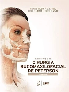 Princípios de cirurgia bucomaxilofacial de peterson 3ª Ediçã - eBooks