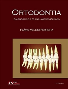 Ortodontia: Diagnóstico e Planejamento Clínico - Vellini - eBooks