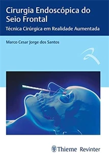 Cirurgia endoscópica do seio frontal: técnica cirúrgica em r - Outros