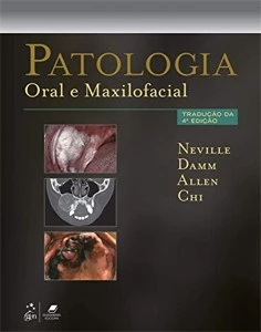 Patologia Oral e Maxilofacial 4 edição - Outros