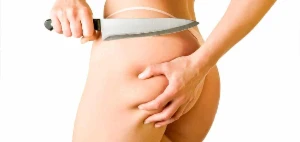 ( 0 Celulites ) Celulitis Cero Produto Vencedor Dolar - eBooks