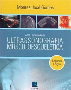 Atlas Comentado De Ultrassonografia Musculoesquelética - Mon - Outros