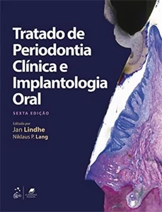 Tratado de Periodontia Clínica e Implantologia Oral 6 edição - Outros