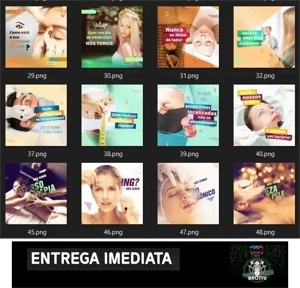 Pack Estética + 145 Artes Para Redes Sociais, Editáveis Psd - Serviços Digitais