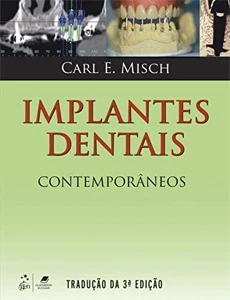 Implantes Dentais Contemporâneos - eBooks