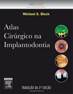 Atlas Cirúrgico na Implantodontia 3ª Edição - Outros