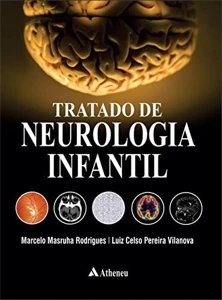 Tratado de neurologia infantil – 1. ed. - Outros
