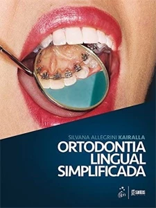 Ortodontia Lingual Simplificada - Silvana Allegrini Kairalla - eBooks
