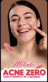 Metodo Acne Zero - eBooks
