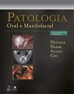 Brad Brad Neville Patologia Oral e Maxilofacial - eBooks