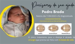 Doação para ajuda na cirurgia do Pedro - Donations
