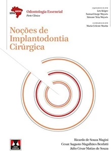Noções de Implantodontia Cirúrgica - Outros