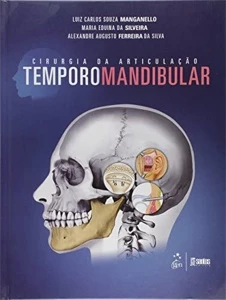Cirurgia da Articulação Temporomandibular - Outros