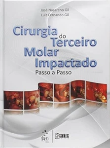Cirurgia do Terceiro Molar Impactado - Passo a Passo - eBooks
