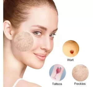 Neatcell Caneta Laser Remover Tatuagem Luz Vermelha - Produtos Físicos