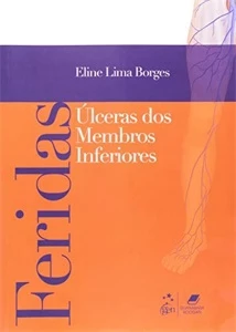 Feridas - Úlceras de Membros Inferiores: Úlceras dos Membros - Outros